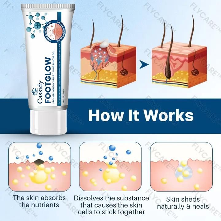 CASSIDY FootGlow Remove gel, 75gm (Pack of 2)
